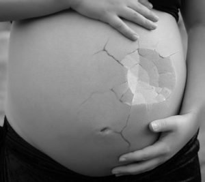 Tipos de Aborto
