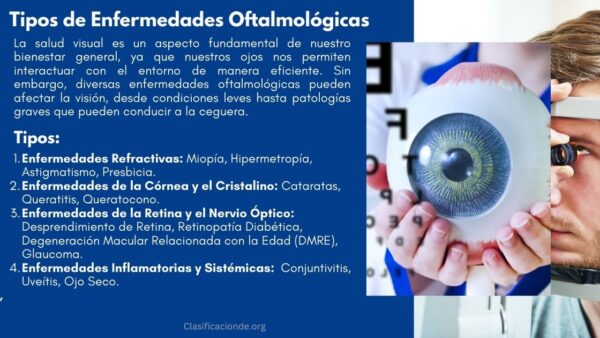 Tipos de Enfermedades Oftalmológicas