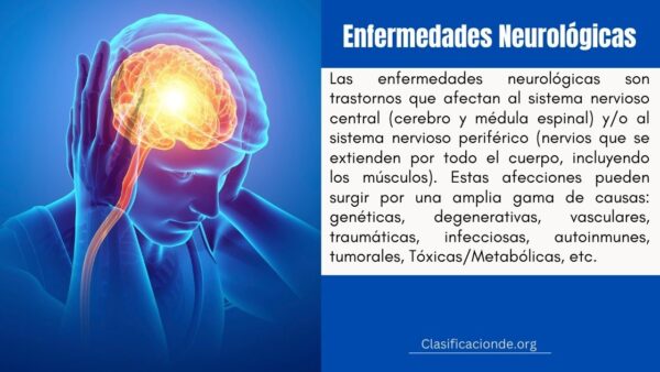Ejemplos de Enfermedades Neurológicas