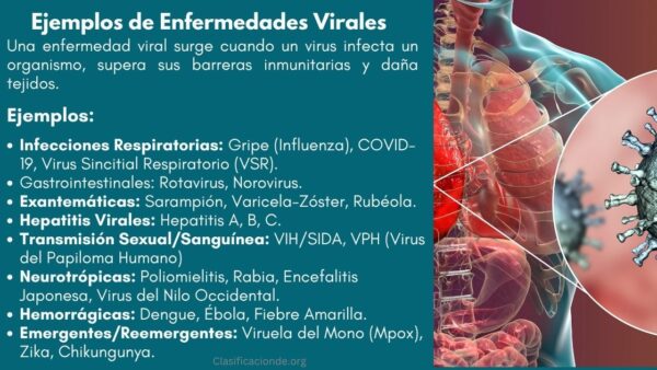Ejemplos de Enfermedades Virales